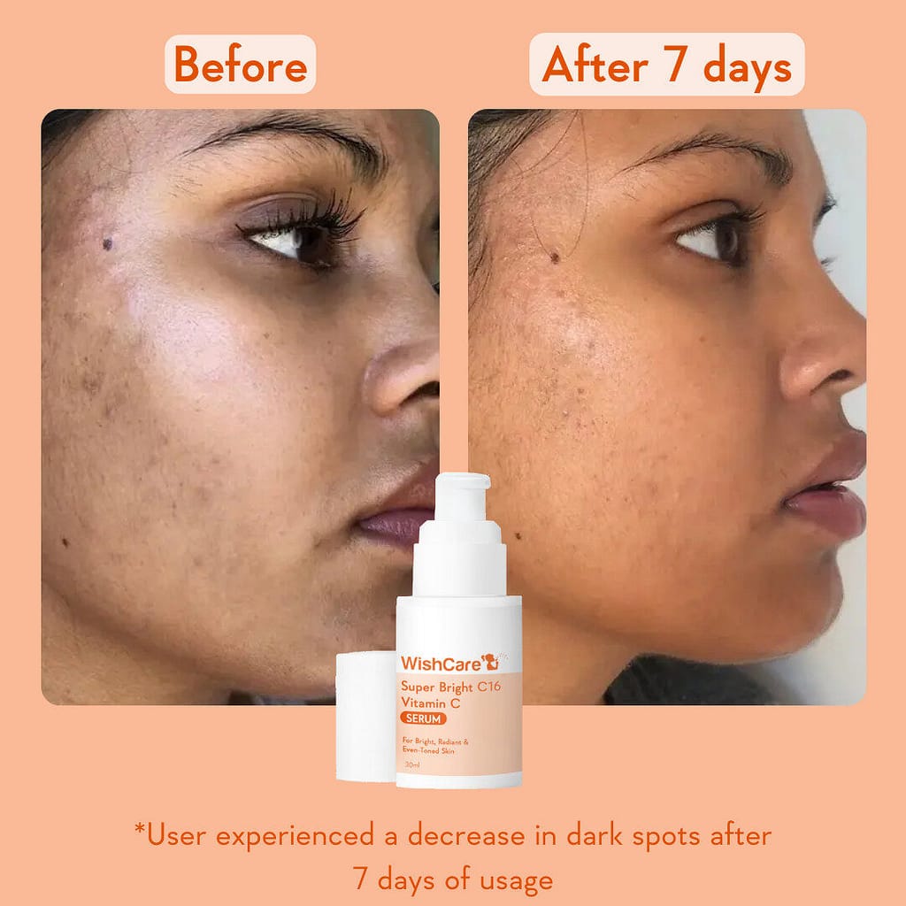 10% vitamin c face serum