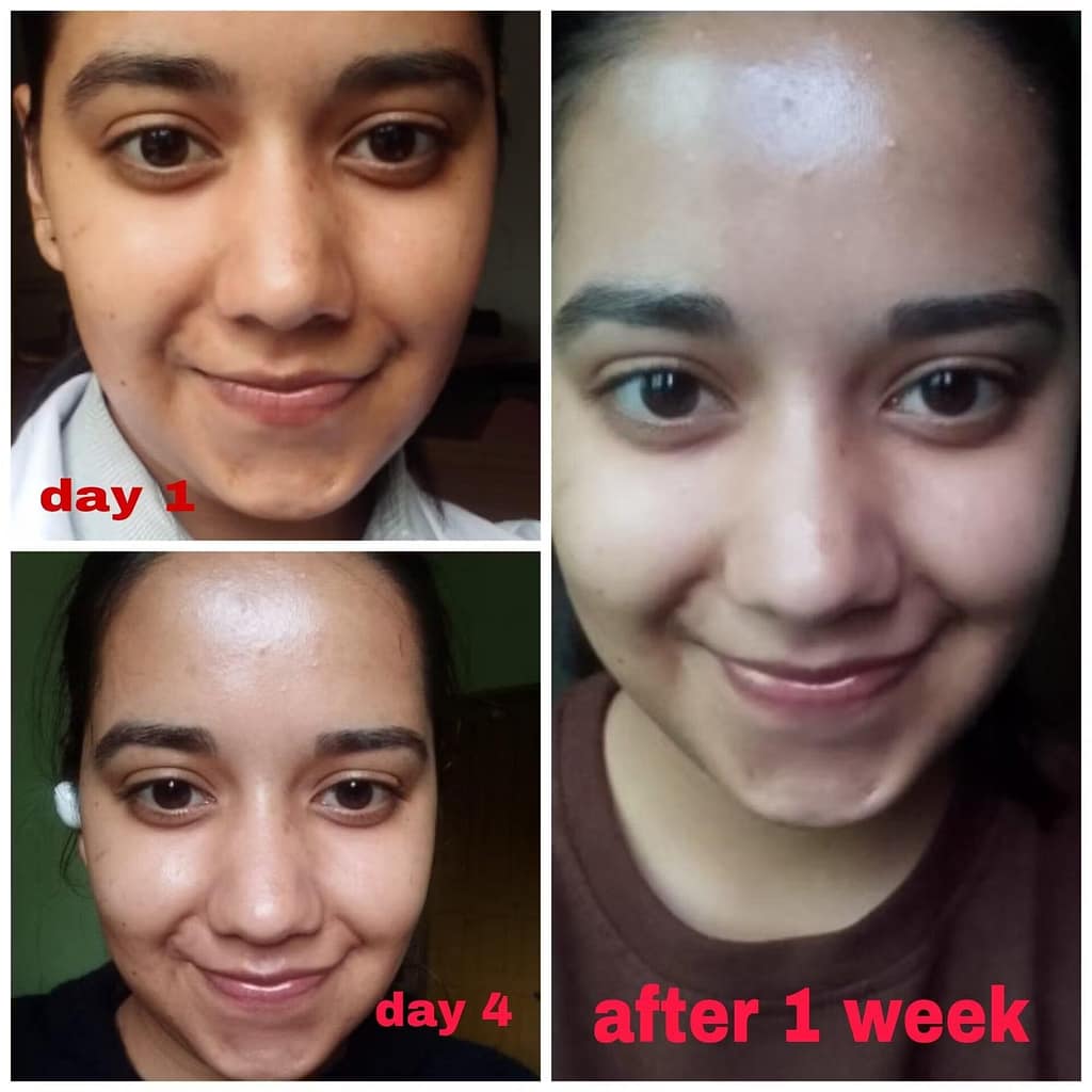10% Vitamin C Face Serum