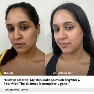 10% vitamin c face serum